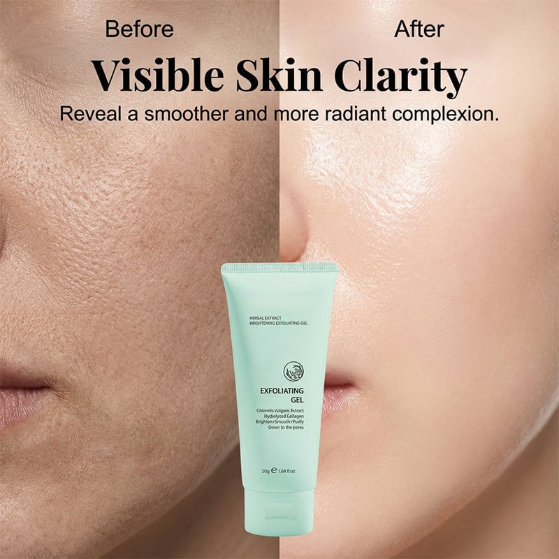 🥳2026 HOT SALE🥳💞50K+ SOLD!💥👵🌸 Herbal Extract Brightening Exfoliating Gel